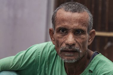 Sundarpur, Bihar Eyaleti, Hindistan, Kasım 2013 'te yerel bir cüzzam hastanesinde kimliği belirsiz Hintli hasta.