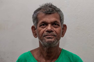 Sundarpur, Bihar Eyaleti, Hindistan, Kasım 2013 'te yerel bir cüzzam hastanesinde kimliği belirsiz Hintli hasta.