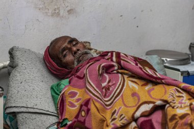 Sundarpur, Hindistan - 2013: Hindistan 'ın Bihar eyaletindeki yerel bir cüzzamlı hastanesinde kimliği belirsiz Hintli cüzzamlı hasta