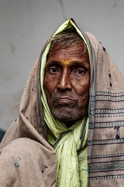 Sundarpur Inde 2013 Patiente Indienne Non Identifiée Atteinte Lèpre Dans — Photo