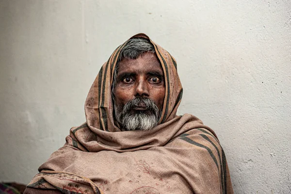 Sundarpur India 2013 Unidentified Indian Leprosy Patient Local Leprosy Hospital — 图库照片