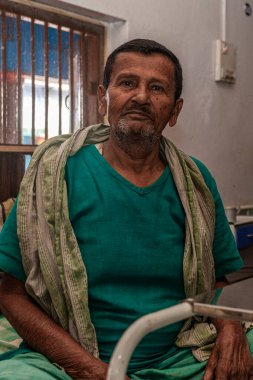 Sundarpur, Hindistan - 2013: Hindistan 'ın Bihar eyaletindeki yerel bir cüzzamlı hastanesinde kimliği belirsiz Hintli cüzzamlı hasta