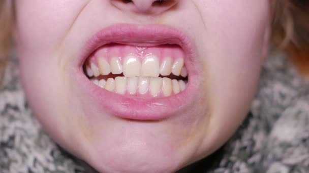 Une vidéo rapprochée d'une bouche et des dents d'adolescentes. 4K UHD — Video