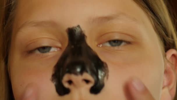 Gezichtsbehandeling. Tiener meisje reiniging van de poriën van haar neus met een modder masker. 4k Uhd. — Stockvideo