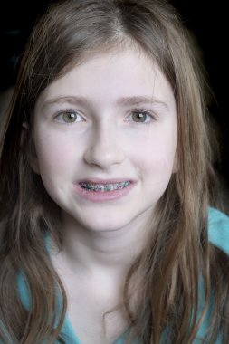 Diş telleri genç kızla gülümseyen