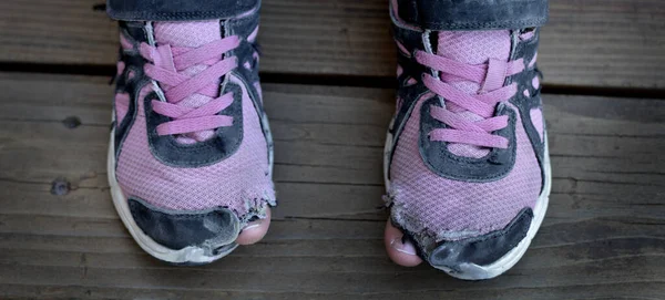 Pessoa Sem Teto Com Dedos Dos Pés Sapatos Desgastados Furando — Fotografia de Stock