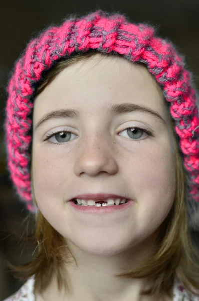 Μικρό κορίτσι χαμογελά λείπει μπροστινό δόντι — Φωτογραφία Αρχείου
