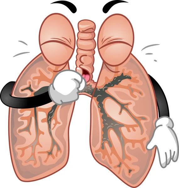 Płuc kaszel gwałtownie — Zdjęcie stockowe