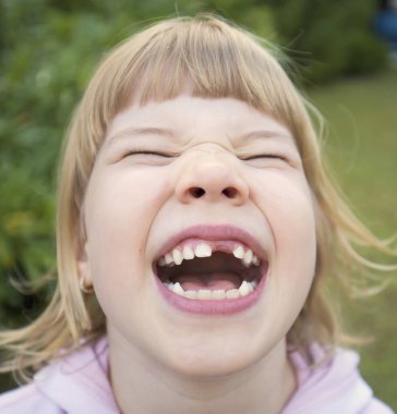Sevimli küçük çocuk, dişleri dökülen suratını buruşturuyor.