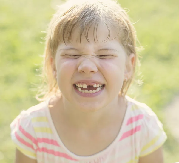 Lindo Niño Pequeño Hacer Mueca Con Dientes Faltantes —  Fotos de Stock