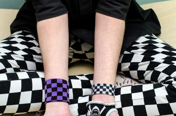 Suicidal depressed girl showing scars from knife cuts on her arms — Stock Photo, Image