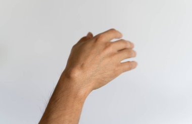 Ganglion cyst on mans hand on white background clipart