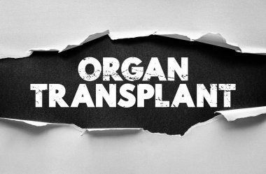 Organ Nakli konsepti yırtık kağıdın altında cesur metinleri gösteriyor. Tıbbi, etik ve sağlık teması cerrahiyi, hayat kurtaran tedaviyi ve bağış onayını sembolize ediyor