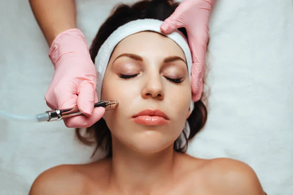 Beautician Performs Microdermabrasion Face Model Close — Zdjęcie stockowe