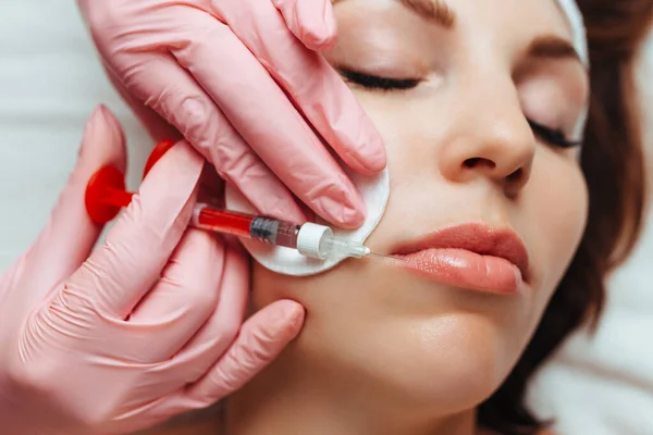 Lip Contouring Cosmetology Fillers Close — Zdjęcie stockowe