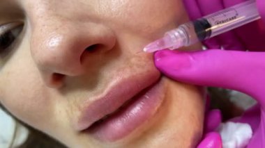 Kozmetik uzmanı kadın derisine hiyalüronik asitle birden fazla enjeksiyon yapıyor, yakın plan. Kadın mesoterapi uygulaması
