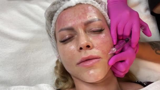 Процедура проти старіння: професійний косметолог робить кілька ін'єкцій у жінок, які стикаються зі шкірою під час мезотерапії. Біоревіталізація та ліфтинг обличчя — стокове відео