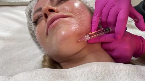 Anti-veroudert procedure: professionele schoonheidsspecialist maakt meerdere injecties in dames gezicht huid tijdens Mesotherapie. Biorevitalization en de opheffing van het gezicht — Stockvideo