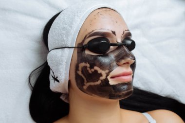 Close-up of cosmetologist's hand making hardware carbon peeling by young pretty customer woman in safety glasses headdress lying on couch in beauty salon. Facial cleaning concept. Cosmetology Services. clipart