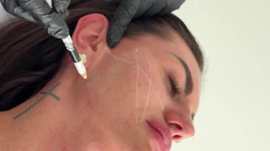 Estetik tıp: Siyah eldivenli kozmetik uzmanı tarafından kadınlara kanül enjeksiyonuyla kolajen biyo-evrizasyon tedavisine yakın çekim.