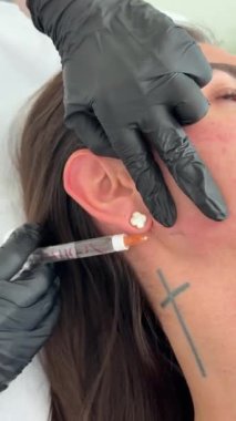 Estetik tıp: Siyah eldivenli kozmetik uzmanı tarafından kadınlara kanül enjeksiyonuyla kolajen biyo-evrizasyon tedavisine yakın çekim.