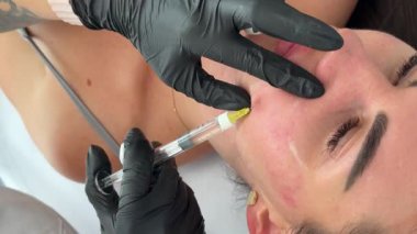 Estetik tıp: Siyah eldivenli kozmetik uzmanı tarafından kadınlara kanül enjeksiyonuyla kolajen biyo-evrizasyon tedavisine yakın çekim.