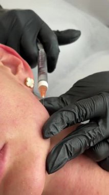 Estetik tıp: Siyah eldivenli kozmetik uzmanı tarafından kadınlara kanül enjeksiyonuyla kolajen biyo-evrizasyon tedavisine yakın çekim.