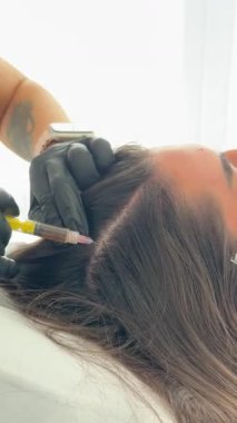 Bir kozmetik prosedürüne yakın çekim: trikoloji uzmanı saç büyümesini teşvik etmek için kafa derisi mezoterapisi enjeksiyonu yapar, şırınga ve kafa derisine seçici odaklanma