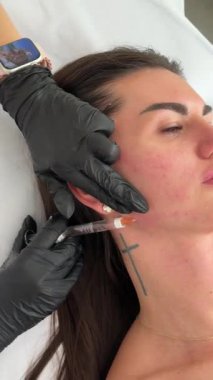 Estetik tıp: Siyah eldivenli kozmetik uzmanı tarafından kadınlara kanül enjeksiyonuyla kolajen biyo-evrizasyon tedavisine yakın çekim.