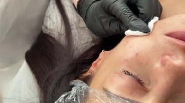 Kozmetik uzmanı, güzellik kliniğinde yaşlanma karşıtı mezoterapi prosedürü sırasında bir kadının gözü altında biyolojik evrim enjeksiyonları gerçekleştiriyor..