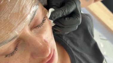 Kozmetik uzmanı, güzellik kliniğinde yaşlanma karşıtı mezoterapi prosedürü sırasında bir kadının gözü altında biyolojik evrim enjeksiyonları gerçekleştiriyor..