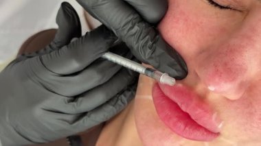 Güzellik kliniği. Eldiven giymiş güzellik uzmanları kadın derisine yüz yaşlanma enjeksiyonu yapıyor. Bir kadın güzellik yüz kozmetolojisi prosedürünü uygular. Botoks. Kolajen enjeksiyonları.