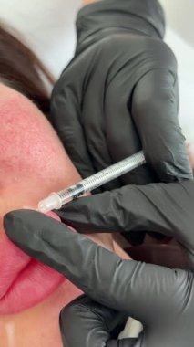 Güzellik kliniği. Eldiven giymiş güzellik uzmanları kadın derisine yüz yaşlanma enjeksiyonu yapıyor. Bir kadın güzellik yüz kozmetolojisi prosedürünü uygular. Botoks. Kolajen enjeksiyonları.