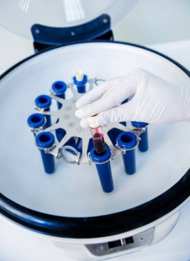 Trombosit zengini plazma hazırlığı. Elleri kanlı tüp
