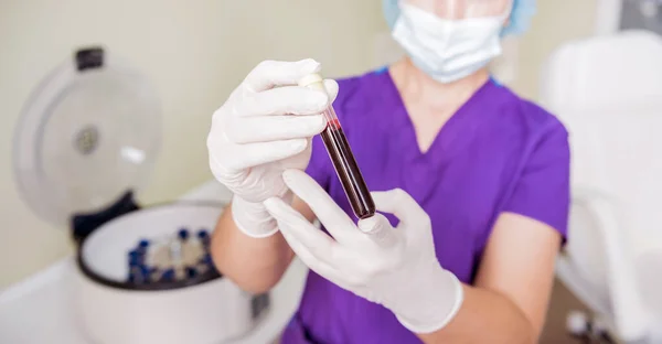 Preparazione al plasma ricco di piastrine. Tubo con sangue nelle mani — Foto Stock