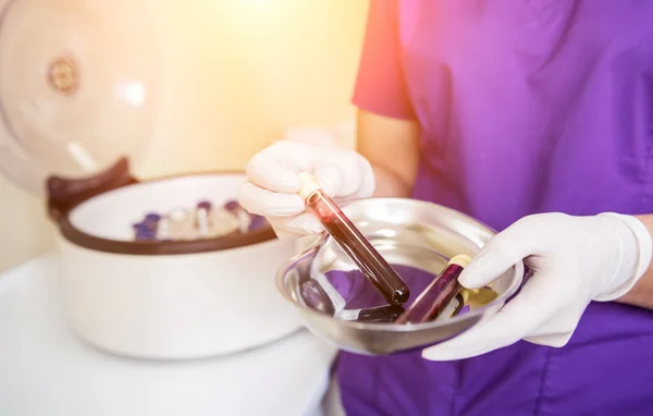 Plättchenreiches Plasma-Präparat. Schlauch mit Blut in den Händen — Stockfoto