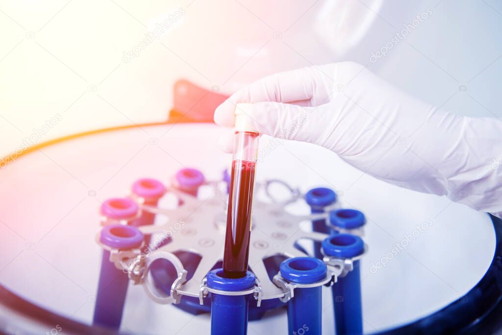 Platelet-Rich plasma preparation. Tube with blood in hands