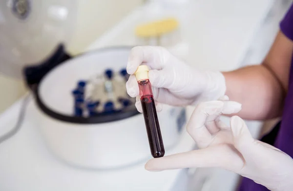 Preparación de plasma rico en plaquetas. Tubo con sangre en las manos —  Fotos de Stock