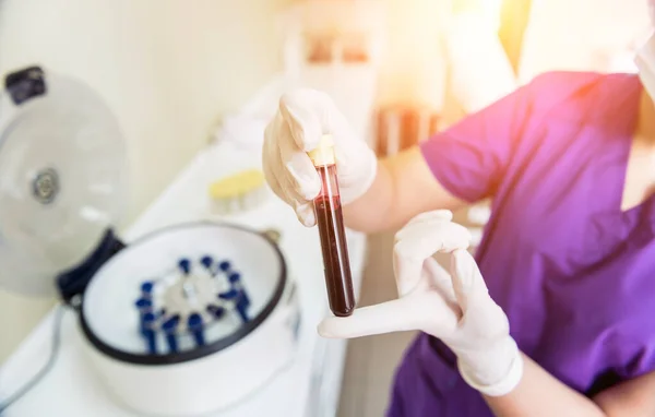 Preparazione al plasma ricco di piastrine. Tubo con sangue nelle mani — Foto Stock