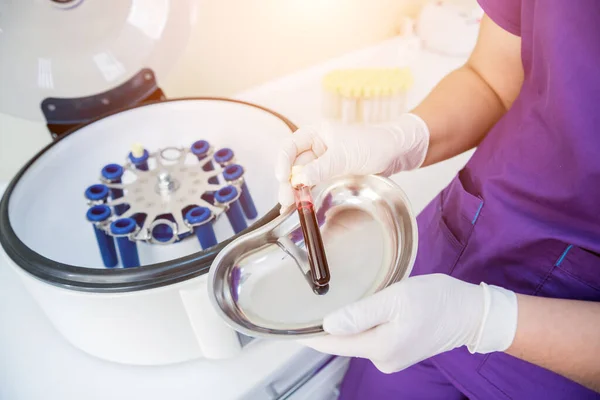 Preparazione al plasma ricco di piastrine. Tubo con sangue nelle mani — Foto Stock