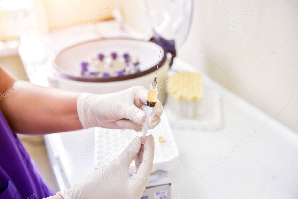 Platelet-Rich plasma preparation. Syringe with plasma in hands