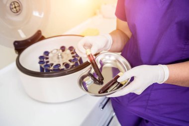 Trombosit zengini plazma hazırlığı. Elleri kanlı tüp