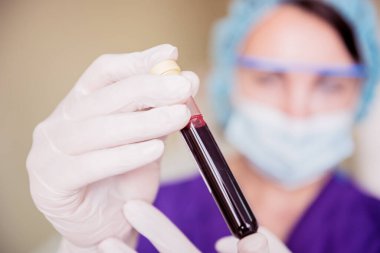 Trombosit zengini plazma hazırlığı. Elleri kanlı tüp