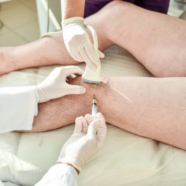 Dizin ultrason güdümlü trombosit zengini plazma enjeksiyonu