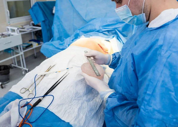 Zvětšení prsou pod vedením týmu chirurgů na operačním sále. — Stock fotografie