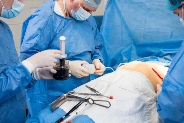 Aumento de senos bajo la guía del equipo de cirujanos en quirófano quirúrgico. —  Fotos de Stock