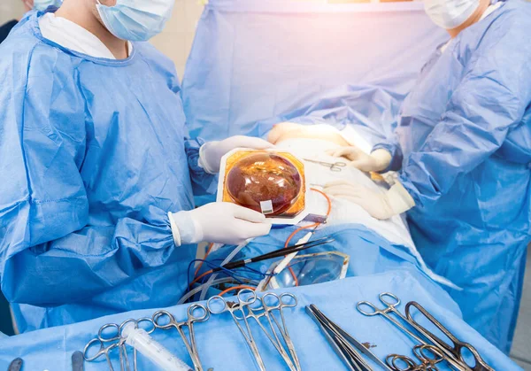 Chirurg na operačním sále drží sterilní prsní silikonový implantát v rukou. — Stock fotografie
