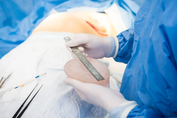 Підвищення грудей під керівництвом хірургів в хірургічній операційній . — стокове фото