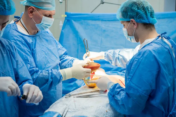 Breast augmentation under the guidance surgeons team in surgical operating room. — Stock Photo, Image