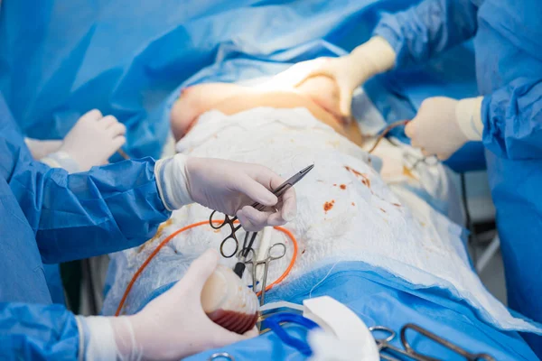 Aumento de senos bajo la guía del equipo de cirujanos en quirófano quirúrgico. — Foto de Stock